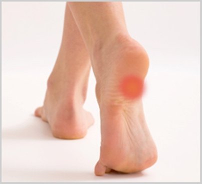 Lately we've been seeing more and more people suffering with heel pain.Heel pain can be completely debilitating for those that suffer with it.
If you're suffering with heel pain or know someone who is, it’s painful,